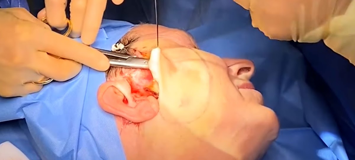 Dr. David Sánchez Escamilla, Monterrey