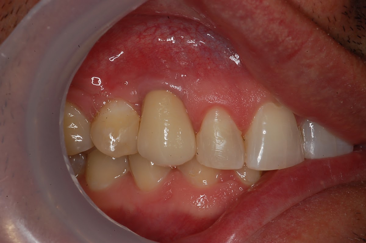 Dental St. Engracia, Monterrey